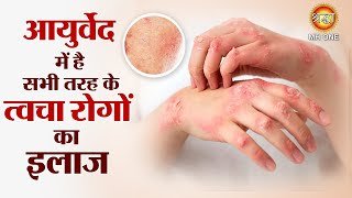 Skin Treatment